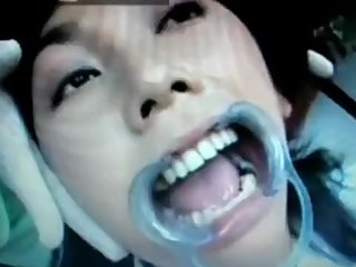 Japanese dental fetish PART 3